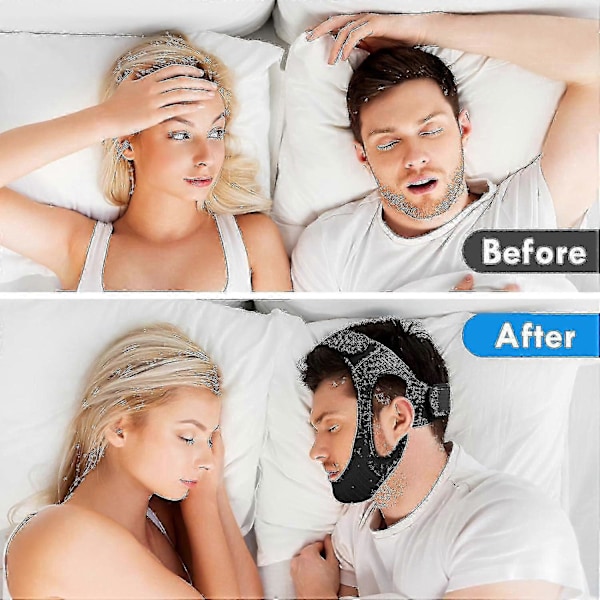 Anti Snore Hagebånd, Opgraderet Stop Snorken Enhed Til Søvn, Effektiv Snorken Løsning, Justerbar & Åndbar Snorkestopper Til Mænd Kvinder