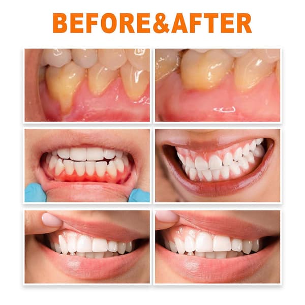 Eelhoe Ampoule Toothpaste, Ampoule Tooth Serum, Ampoule Essence Toothpaste 3st