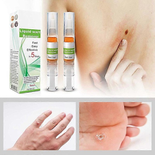 Borttagningsmedel för liktornar, förhårdnader och valkar, flytande, 3 ml, ny