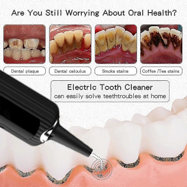 Guoguo Multifunktionel Elektrisk Tandrenser Dental Scaler Pletfjerner Mundpleje USB Genopladeligt Tænderensningssæt
