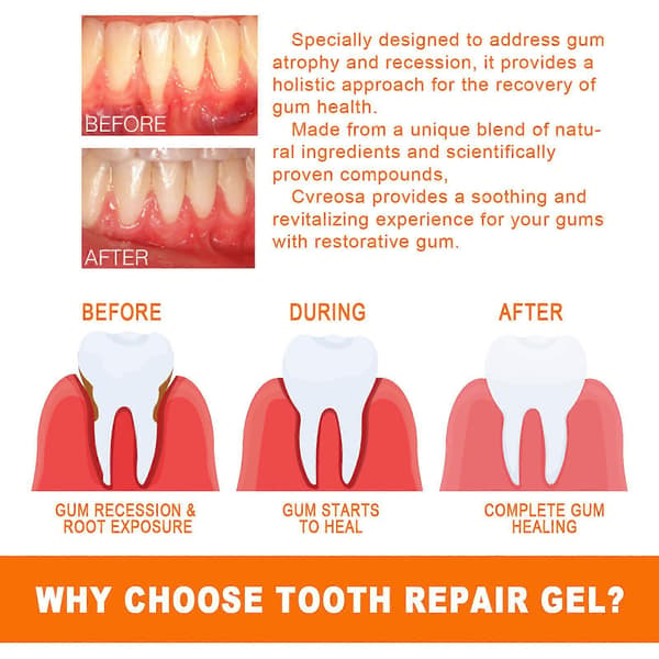 Eelhoe Ampoule Toothpaste, Ampoule Tooth Serum, Ampoule Essence Toothpaste 3st