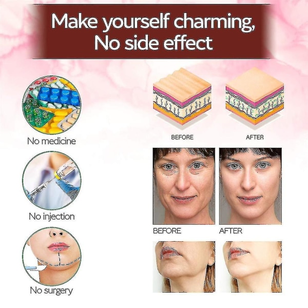 Tflycq Gjenbrukbar V-linjemaske Facial Slanking Strap Double Chin Reducer
