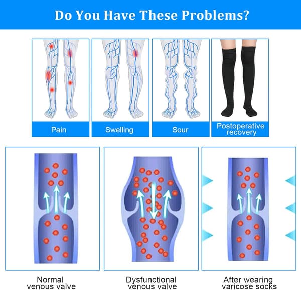 Thigh High Compression Strumpor för Kvinnor & Män, 15-21 mmHg, Stängd Tå för Ödem & Graviditet Level 1