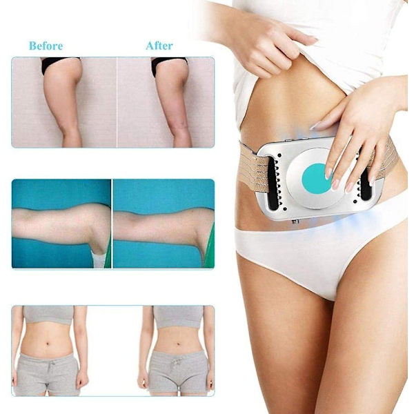 frysning kropp bantning maskin frys lipo anti celluliter