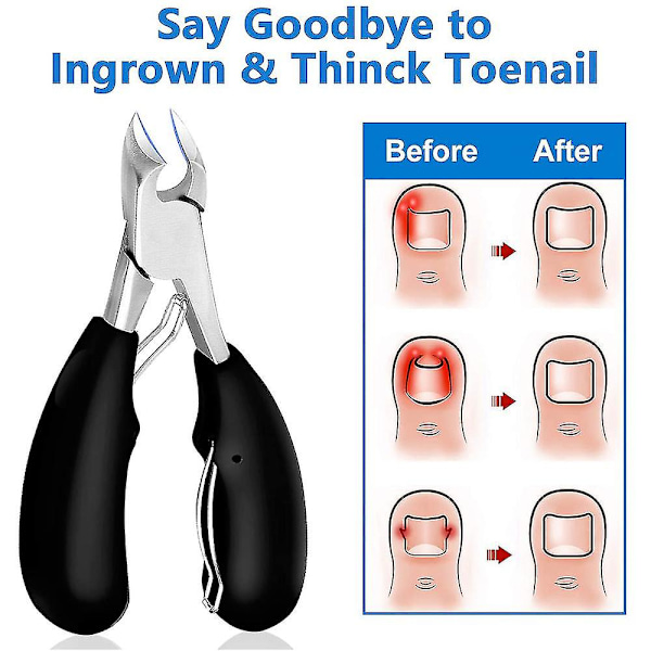 Tånegleklipper for tykke, inngrodde tånegler - Heavy Duty presisjonssaks