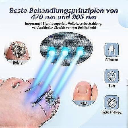 UV-kynsilamppu, kynsienhoitolaite, erittäin tehokas kynsiterapia puhdistaa kynnet