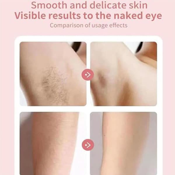 Uppladdningsbar USB-epilator för kvinnor, vit - Ansikte/Händer/Ben