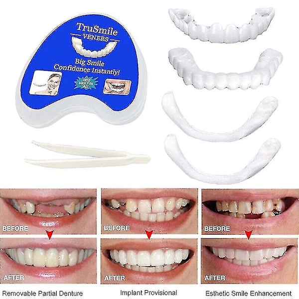 Smile Snap On False Teeth Upper Lower Dental Veneers Dentures Tooth Cover Set