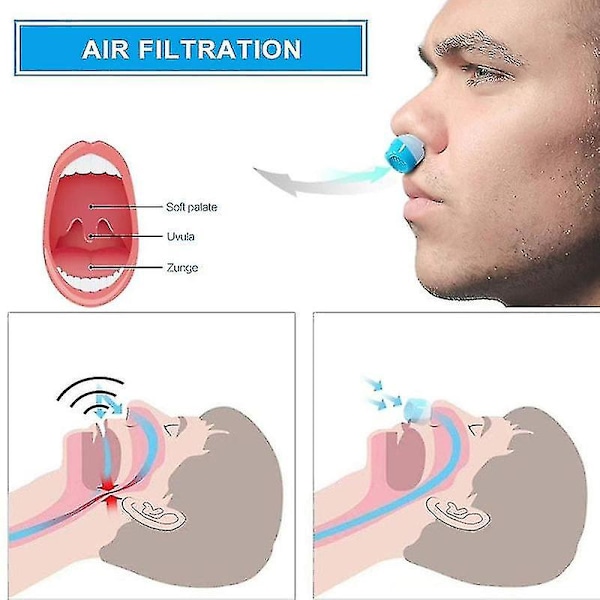 Søvnstøtte Silikon Anti Snorking Enhet Nesedilatatorer Anti Snorking Stopper Neseklype Apnévakt Lett Åndedrett Forbedre Søvn (blå)