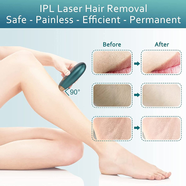 Epilator Bærbar Smertefri Laser Epilator Til Blød Hud