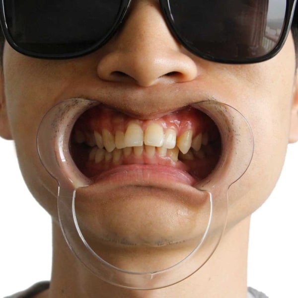Dental munöppnare kindupprullare, paket med 18 munstycken för Funny