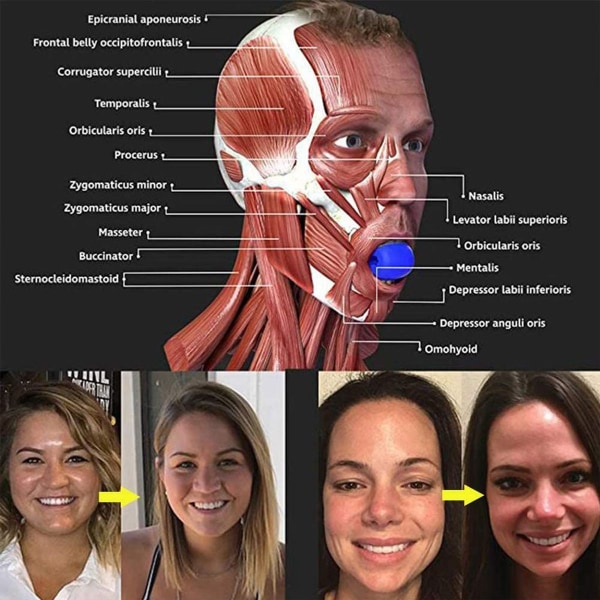 Käktränare Käk Facial Firmer Svart KLB