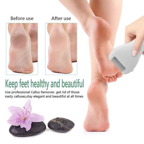 Elektrisk fodkværn Digitalt display USB genopladelig pedicure pedicure