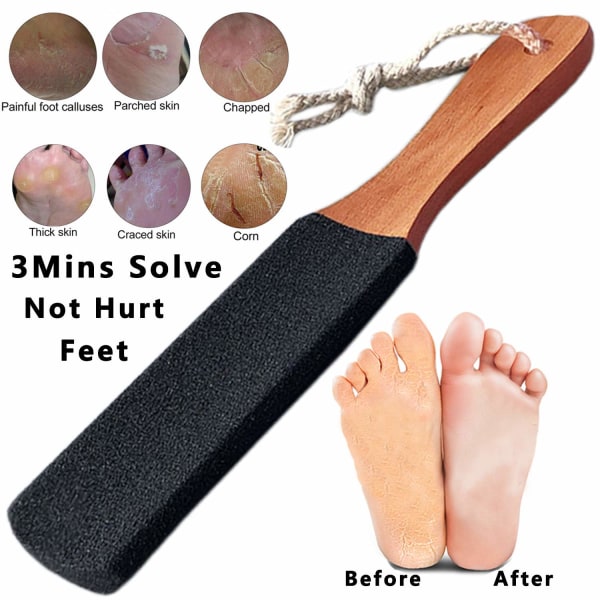 Fodfil Callus Remover Fodskrubber, Professionel Pedicure Fodrasp Fjerner Revnede Hæle, Død Hud, Hård Hud