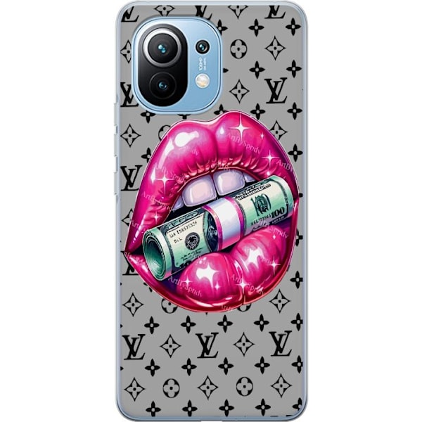 Xiaomi Mi 11 Gennemsigtig cover LV Money Lip