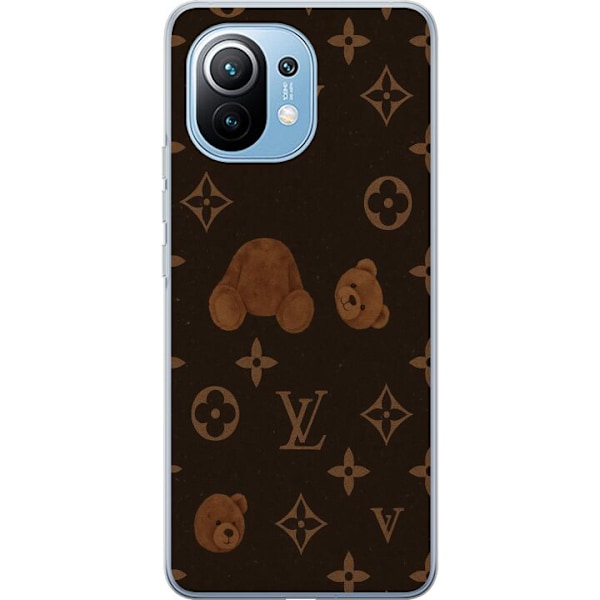 Xiaomi Mi 11 Gennemsigtig cover Plush Luxe