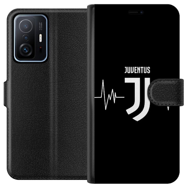 Xiaomi 11T Lommeboketui Juventus