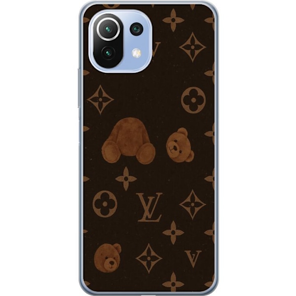 Xiaomi Mi 11 Lite Genomskinligt Skal Plush Luxe