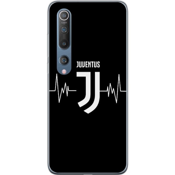 Xiaomi Mi 10 5G Gjennomsiktig deksel Juventus