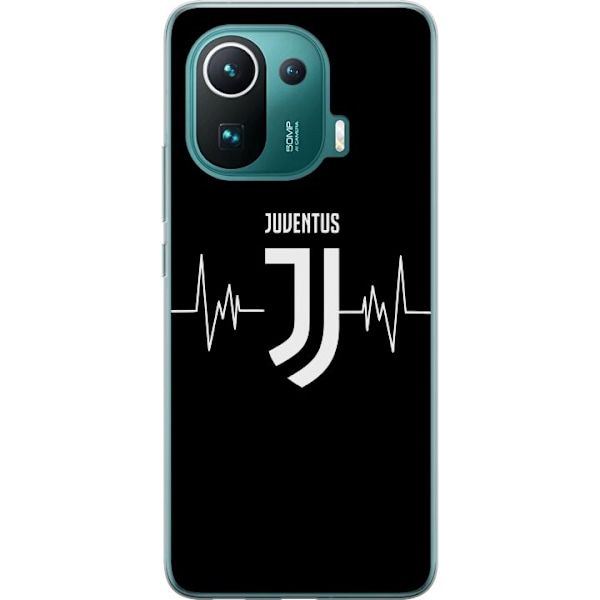 Xiaomi Mi 11 Pro Gennemsigtig cover Juventus