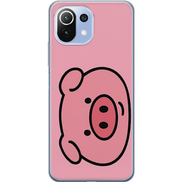 Xiaomi Mi 11 Lite Gjennomsiktig deksel Kawaii Piggy