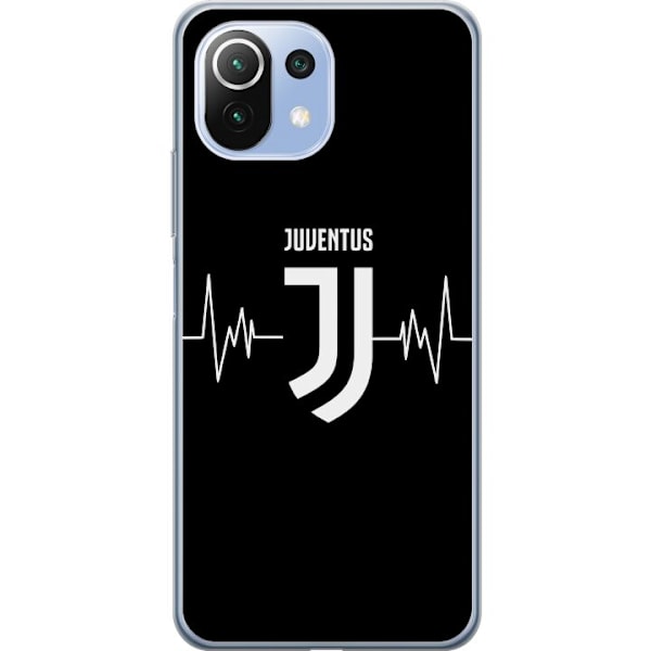 Xiaomi Mi 11 Lite Gjennomsiktig deksel Juventus