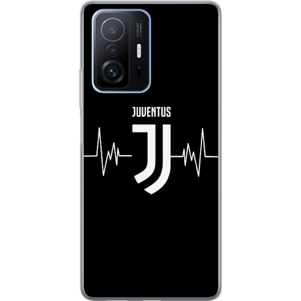 Xiaomi 11T Läpinäkyvä kuori Juventus