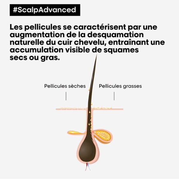 L'Oréal Scalp Advanced Anti-Dandruff Shampoo 500 ml