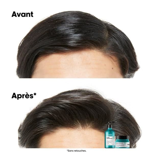 L’Oréal Professionnel Scalp Advanced - Dermo-puhdistava shampoo - 500 ml