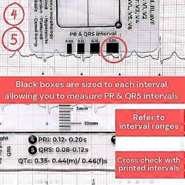 Lille Elektrokardiogram 7-Trins Lineal Praktisk Kompakt EKG Lineal til Brug På Farten (Kun Lineal)