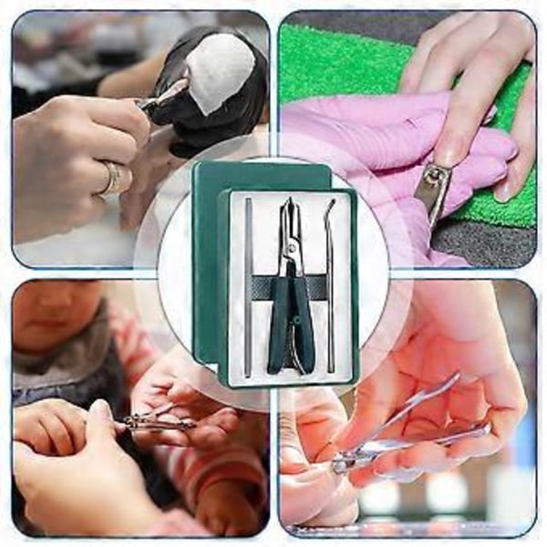 Tånagelklippare Pedikyrverktyg Örnäbbsformade Fasade Nagelklippare för Hemmabruk och Resor (Grön)