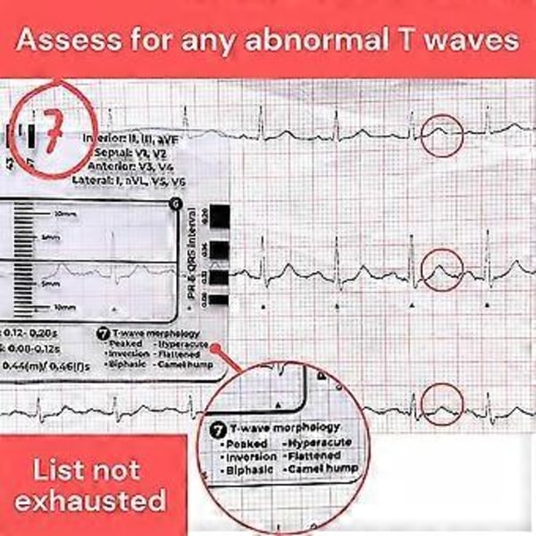 Liten Elektrokardiogram 7-stegs Linjal Bekväm Kompakt EKG-linjal för Användning i Farten (Med fodral)