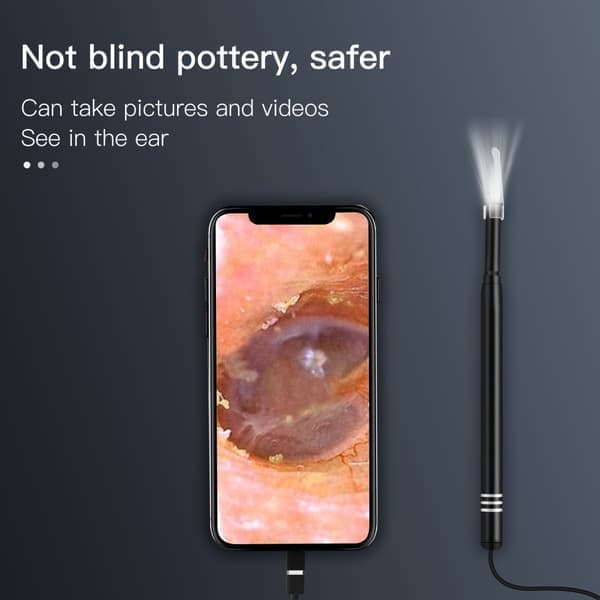 Visuell ørerenser ørevoksfjerner med kamera og LED-lys Svart—pa