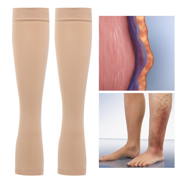 Medical Knee High Compression sukat jalkoja laihduttavat suonikohjuja sukat vartalonhoito (Polvi High Open Toe Skin Color XL)