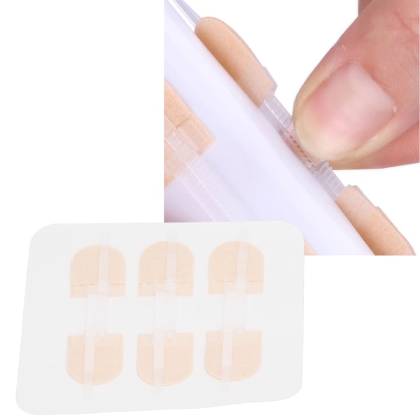 3 stroppe lynlås sårlukningsplastre åndbare sømløse elastiske lynlåssuturer Bandager til sårpleje 90 X 20 mm / 3,5 X 0,8 tommer