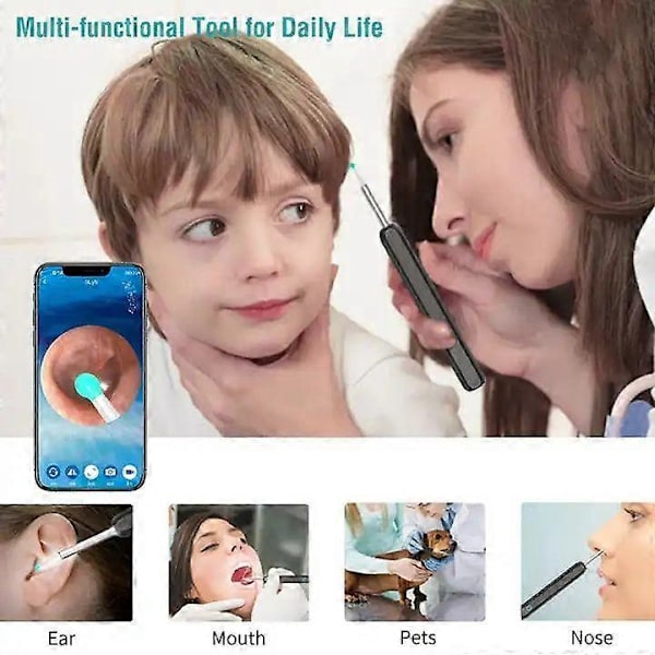 Langaton Älykäs Visuaalinen Korvanpuhdistin Usb WiFi Otoskooppi TW1 Korvavahanpoistotyökalu Setti Kameralla Korvaendoskooppi HD 1080P iPhone iPad Android [db]