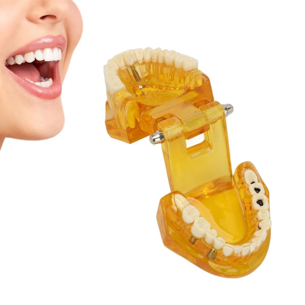 Tandpatologisk model Klar struktur Pædagogisk tænder Display Model Transparent Gul