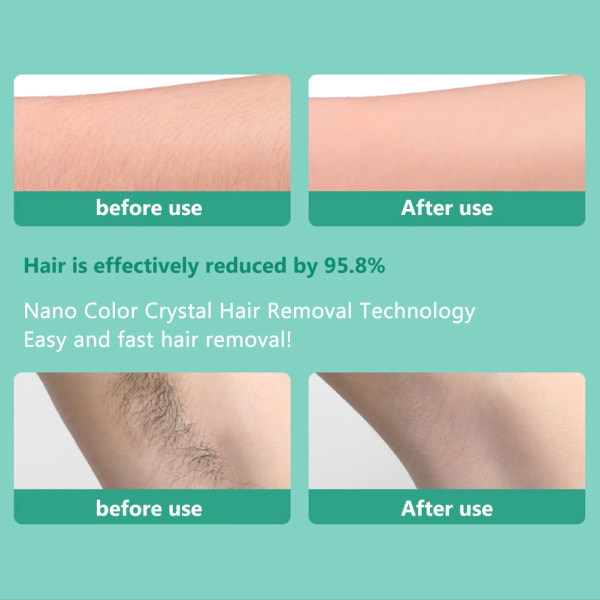 Nano hårborttagningsmedel skonsam hårborttagning utan rakning.