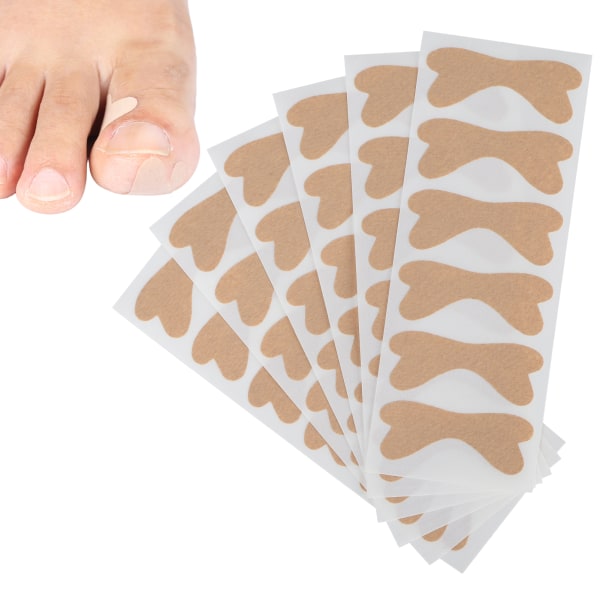 Profesjonell tåneglkorrigeringslapp Inngrodd tåneglkorreksjonsklistremerkesett Fotpleie36stk