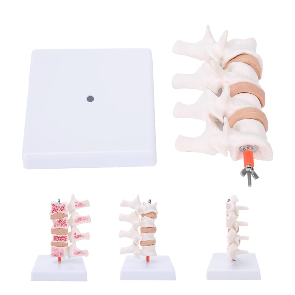 Ammattimainen osteoporoosimalli Ihmisen anatominen selkärangan malli opetusesittelyyn