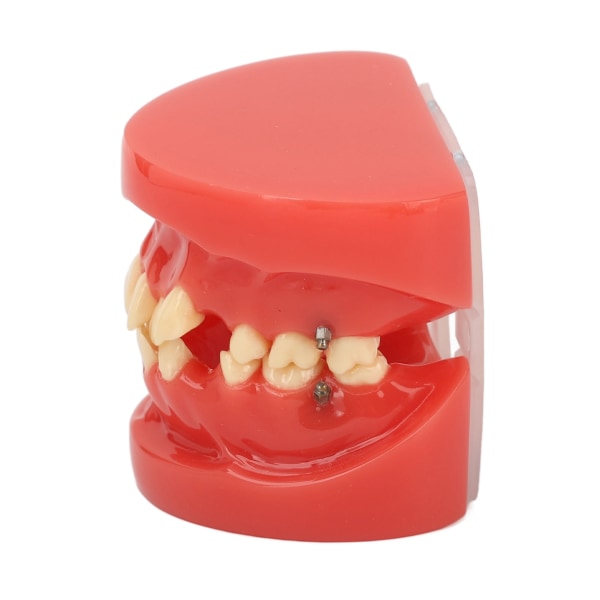 Dental Typodont Ortodontiska tänder Modell Undervisningsverktyg 24 tänder Harts Dental Demonstration Study Model