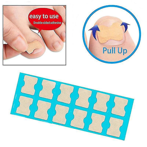 36pcs Nail Correction Stickers Toenail Patch Eingewachsene Paronychie Pedicure Tool Toe Inlay Corrector Elastic Nail Patch