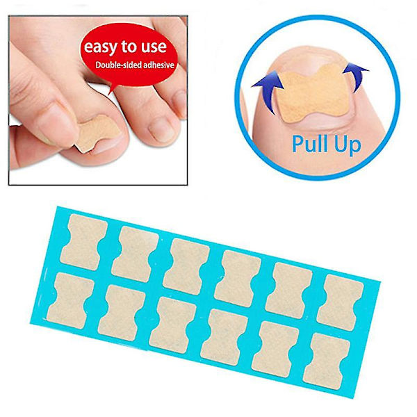 36 st nagelkorrigering klistermärken tånagel lapp inåtväxt paronychia pedikyr verktyg tå inlägg korrigerare elastisk nagel lapp 72Pcs