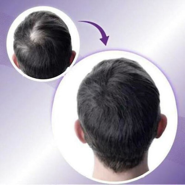 Clip-on Hair Topper Varmebestandig fiber hårforlængelse paryk Hårstykke til kvinder 8