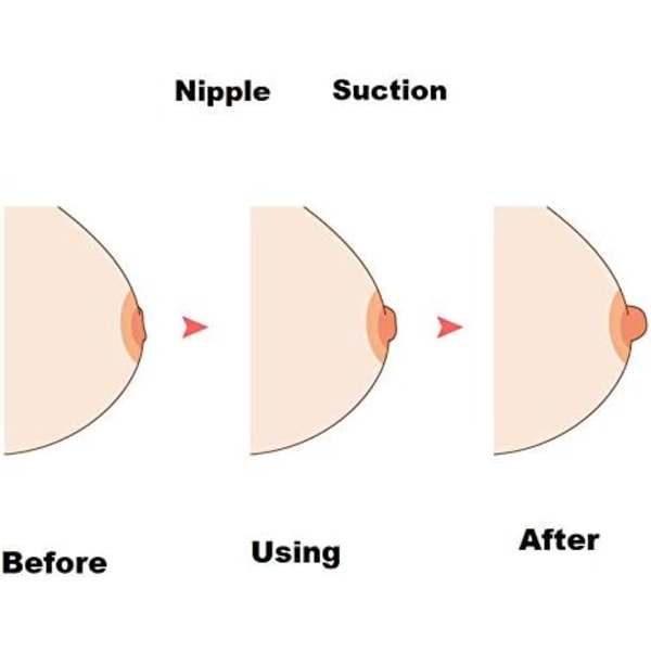 Nipple Corrector til omvendt brystvortepumpe eller forlænger, låseforstærkningshjælpemiddel med støvtæt etui til kvinder, mor, amning, brun farve