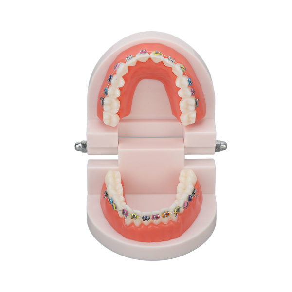 Tandtypodont-tandmodell med ortodontisk metallfäste för tandläkare som undervisar i forskning Dentallaboratorium