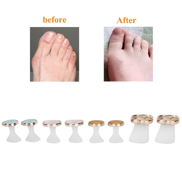 8 stk Silikon Nail Art Toe Separator Vaskbar Gjenbrukbar Toe Separator Tool Pedicure CareMY-02