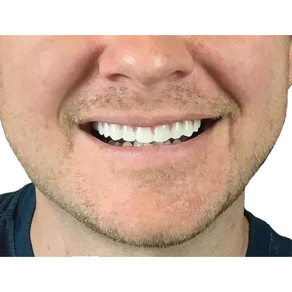 Faner Kosmetiska tänder Vita tänder cover Silikonsimulering Övre proteser Simuleringsproteser Plastproteser