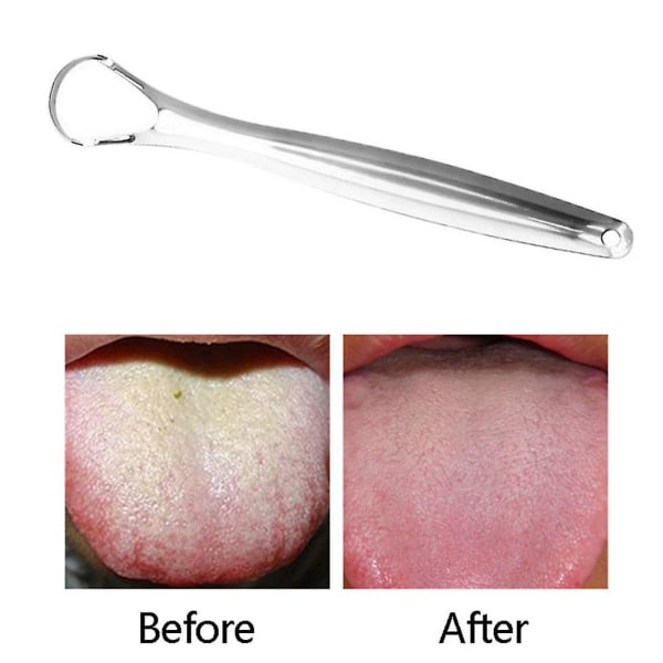 2-pack återanvändbar tungskrapa Rostfritt stål tungrengöringsmedel Tandvård Hygien oral