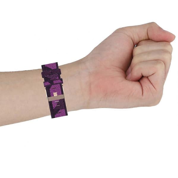 Pustende erstatningsrem for Fitbit Versa4 - Smartklokkearmbånd, bærbart yellow